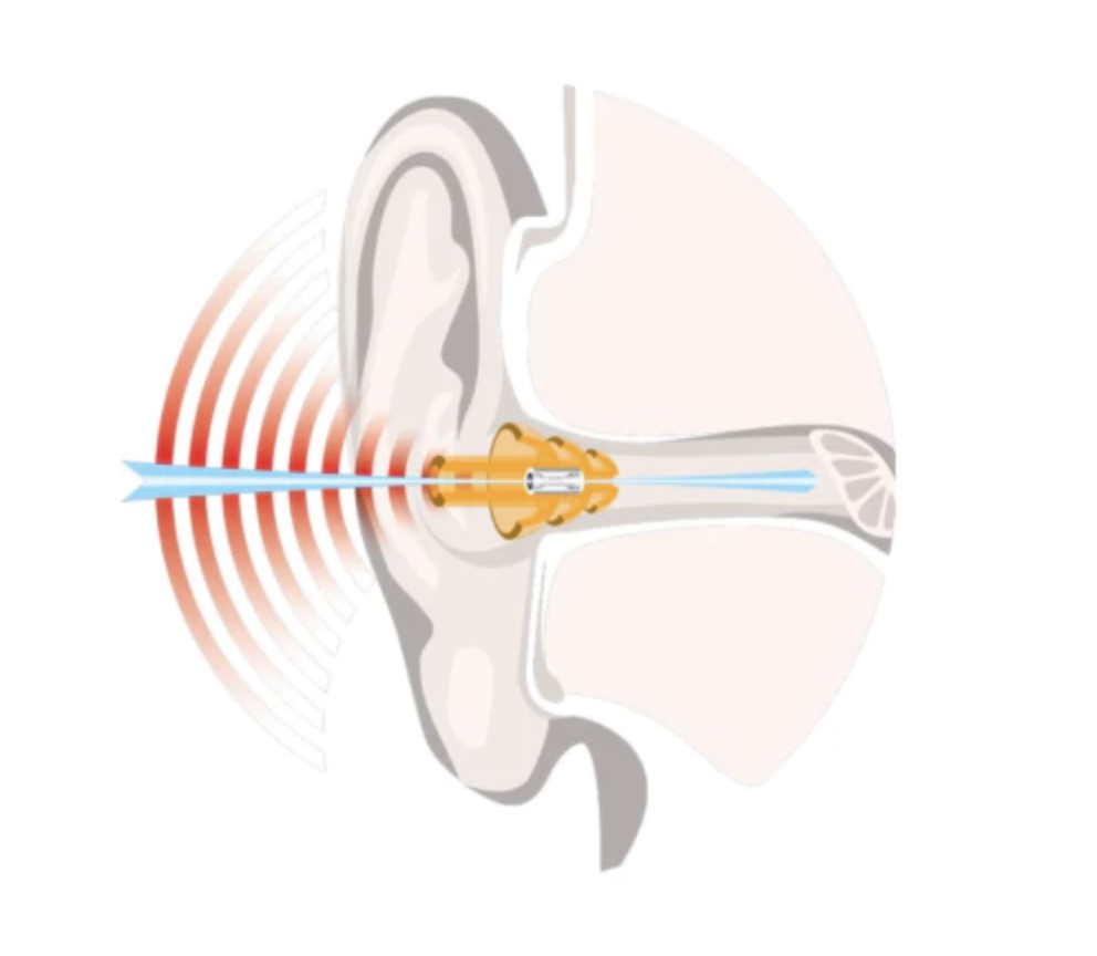 SLEEP EAR PLUGS